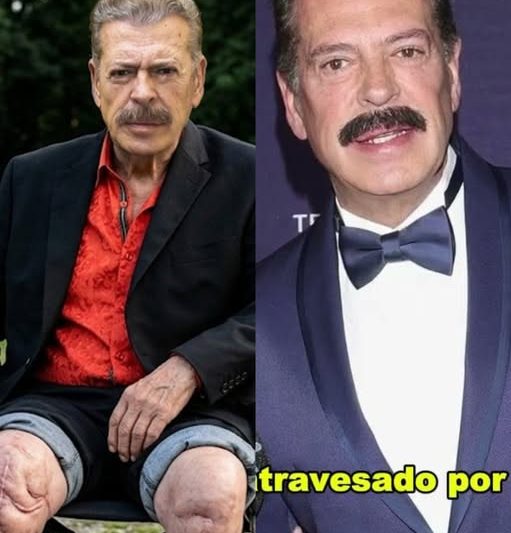 A Los 67 Años, Sergio Goyri Finalmente Admitió Lo Que Todos Sospechábamos.  tl