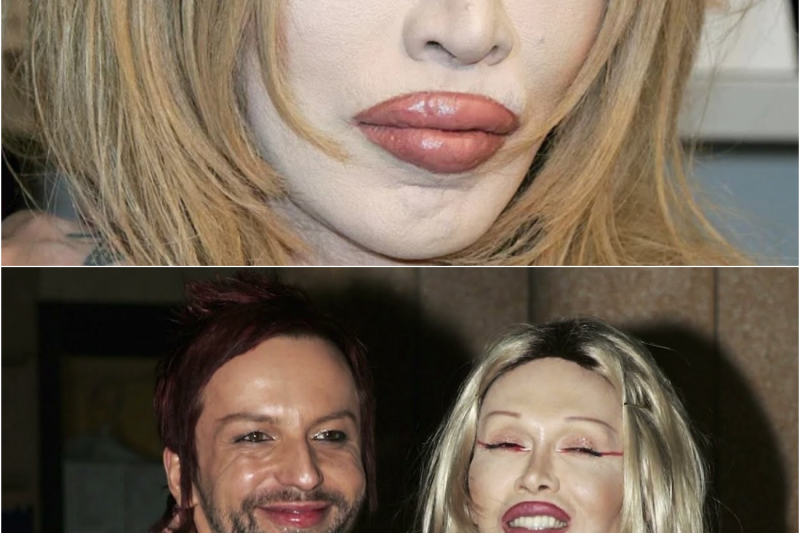 La Trágica y Desgarradora Vida de Pete Burns: Entre el Estrellato Global de los Ochenta, la Obsesión Estética y la Ruina Absoluta