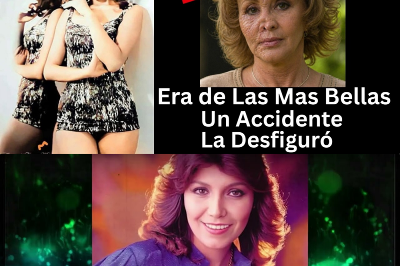 La Triste Historia de Hilda Aguirre | El Terrible Accidente que Cambio su Vida