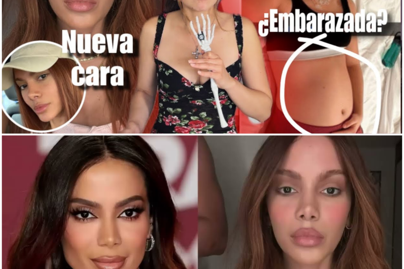 Cirugías, Secretos y Escándalos Judiciales: La Verdad Detrás de Anitta, Sam Smith, Jojo Siwa y el Caso P. Diddy