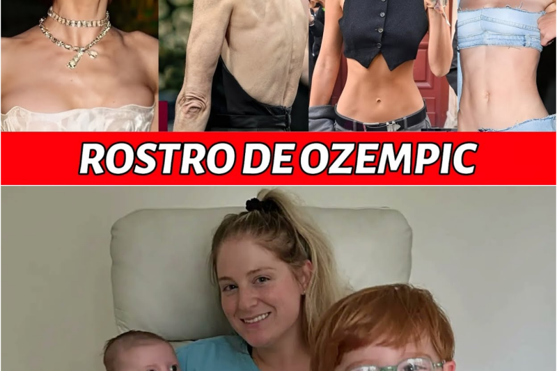 El Lado Oscuro de la Aguja Milagrosa: Hipocresía, Negación y el Aterrador “Rostro Ozempic” que Consume a Hollywood