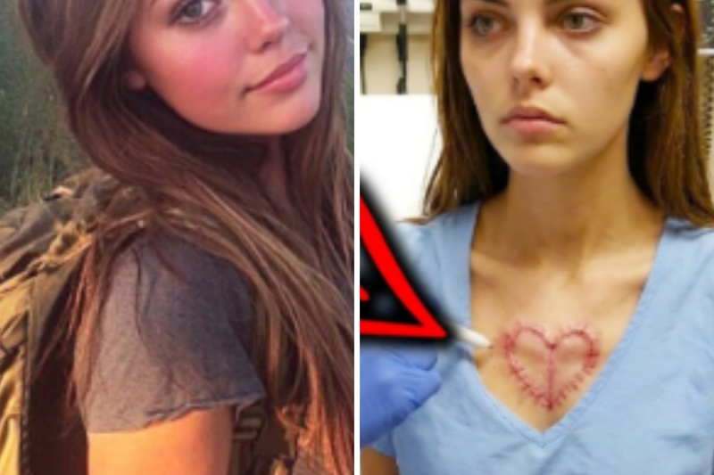 Desapareció En Montana; 4 Años Después Fue Hallada Con Una Cicatriz En Forma De Corazónn