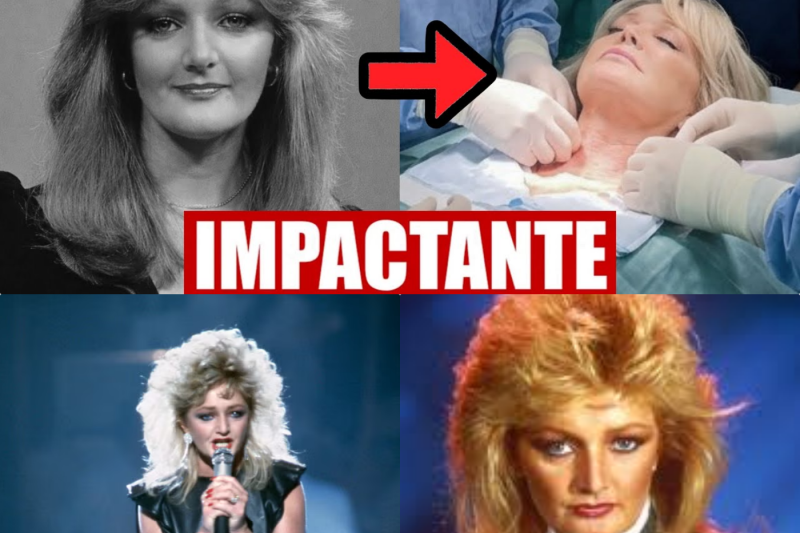 La Verdadera Historia Detrás de la Voz de Bonnie Tyler: Entre el Accidente que la Marcó y los Escándalos que Sacudieron su Vida