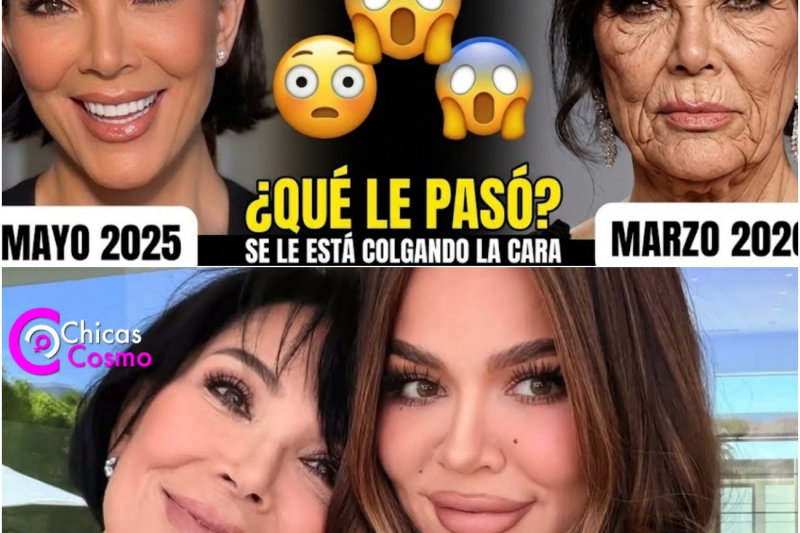 ¿Colapso Estético o Crueldad en Redes? La Verdadera Situación de Kris Jenner Tras su Reciente Transformación Facial