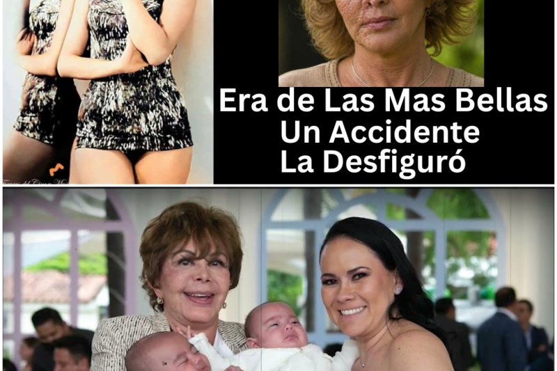 El Rostro Destrozado y el Alma Inquebrantable: La Trágica, Fascinante y Dolorosa Vida de Hilda Aguirre