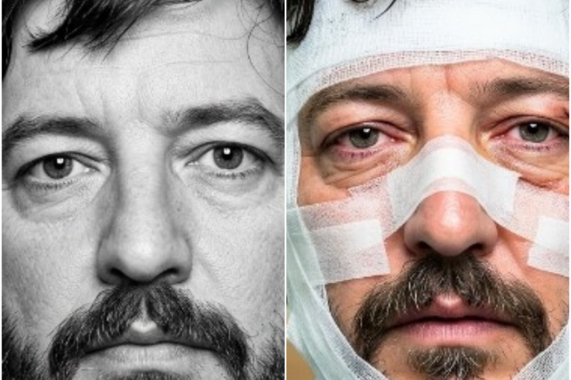 Amado Carrillo: Quiso BORRAR Su Rostro para DESAPARECER… Y Los Médicos aparecieron MUERTOS