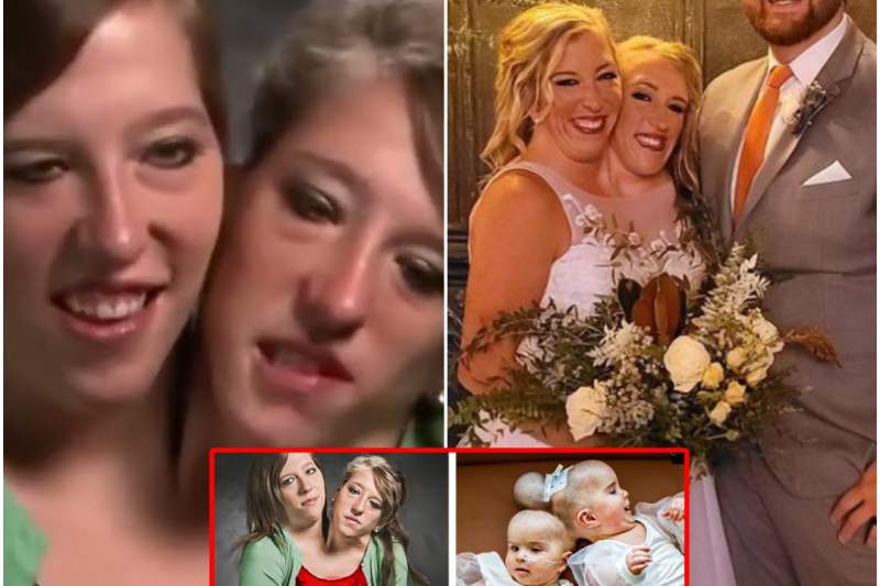 El Secreto Nupcial que Fracturó a una Familia: La Dolorosa Verdad Sobre Abby y Brittany Hensel