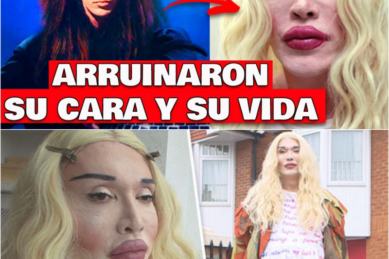 El rostro de la tragedia: La vida de Pete Burns, el ícono que la adicción a las cirugías destruyó