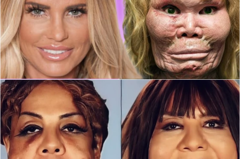El Oscuro Precio de la Perfección: Las Escalofriantes Historias de Celebridades Destruidas por la Cirugía Plástica