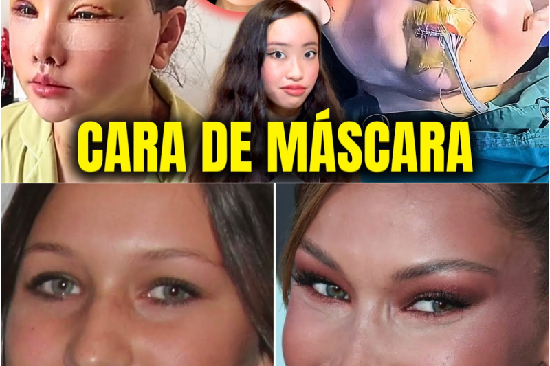 Pagaron Miles por Rejuvenecer y Terminaron con el Rostro Estirado como Goma: El Oscuro Negocio de la Eterna Juventud