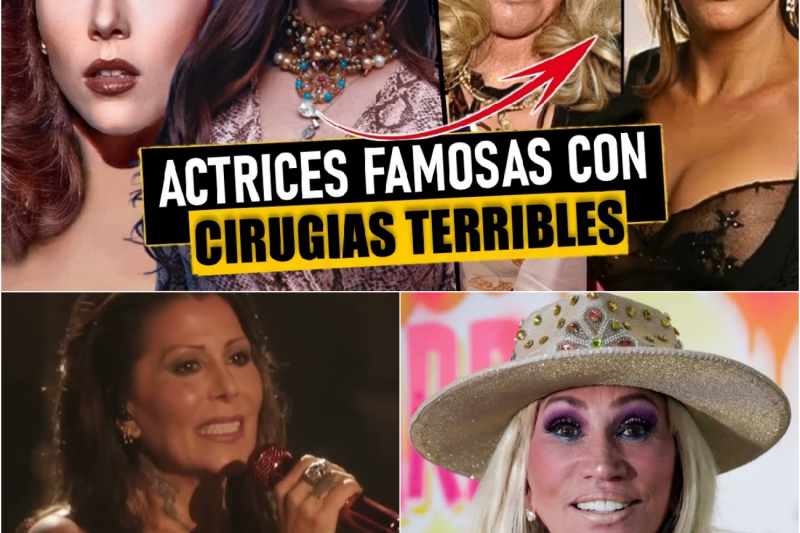 El Precio de la Belleza Eterna: Las 7 Estrellas Irreconocibles que Perdieron su Rostro por el Bisturí