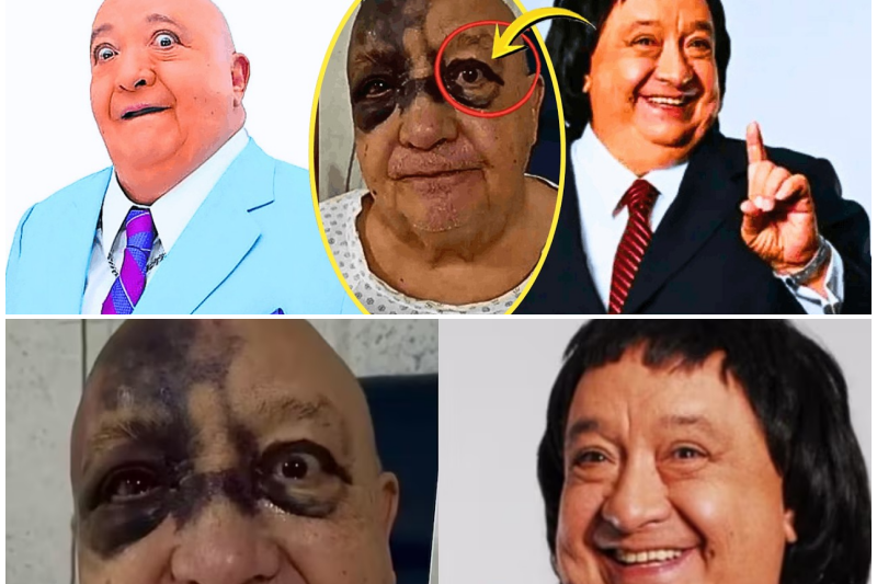 De la Cima de la Fama al Borde del Abismo: La Impactante Verdad Sobre Luis de Alba y Su Vida Hoy