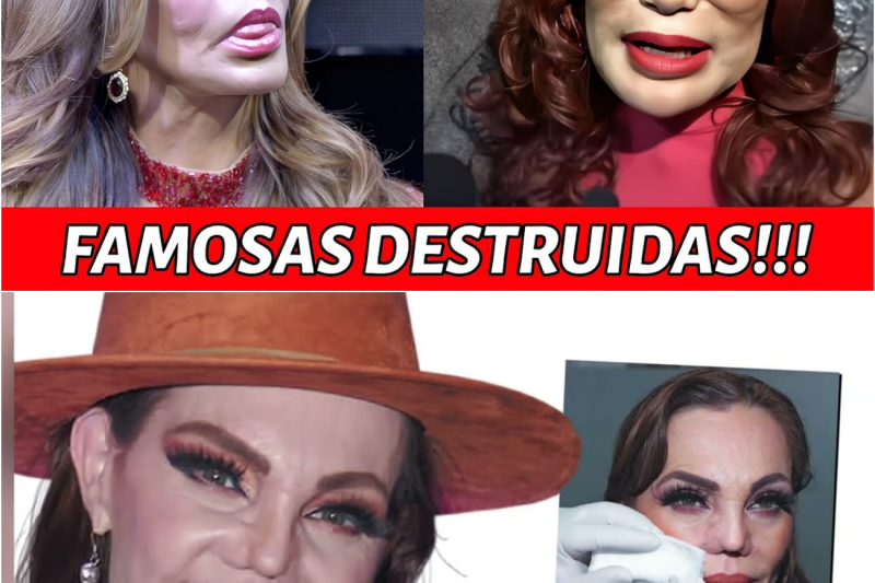 El lado oscuro de la perfección: Cuando el bisturí se convirtió en la pesadilla de las estrellas latinas