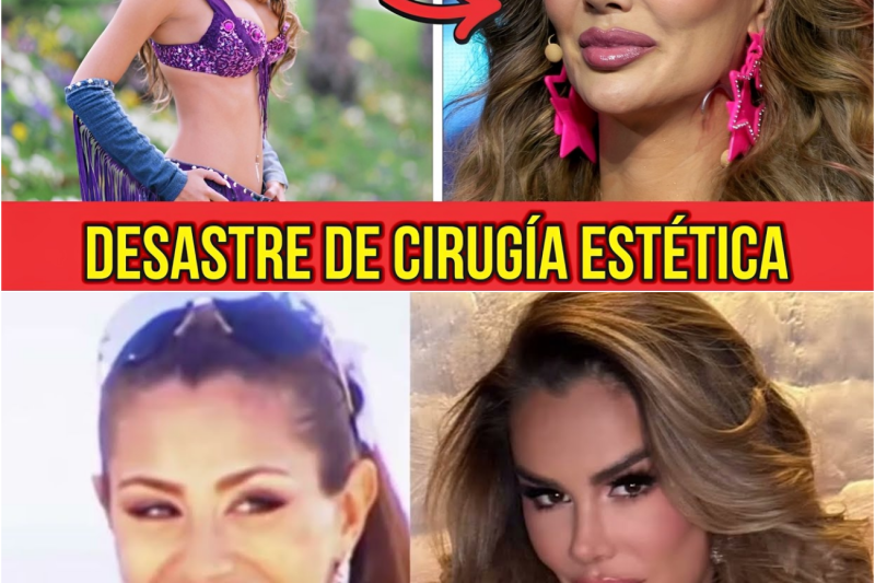 El Alto Precio de la Perfección: Las Tragedias Irreversibles de los Famosos que Fueron Destruidos por el Bisturí
