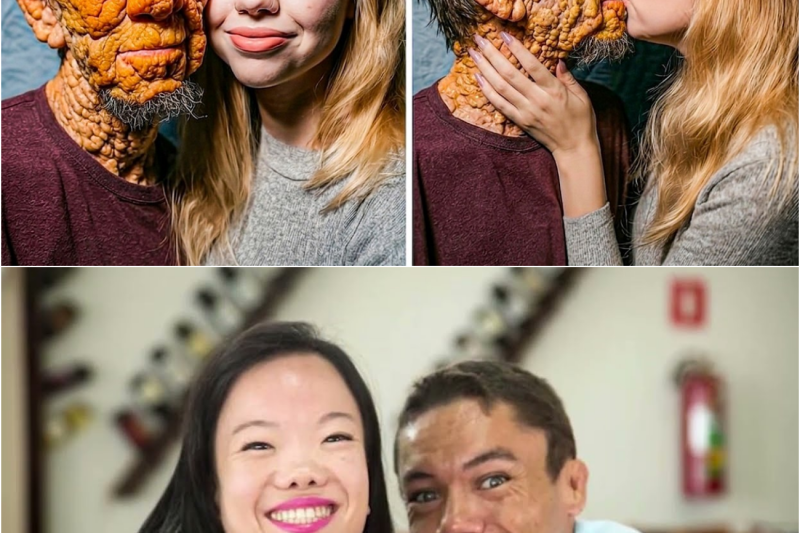 Amor sin límites: 10 parejas que desafían la lógica y han conmocionado al mundo entero
