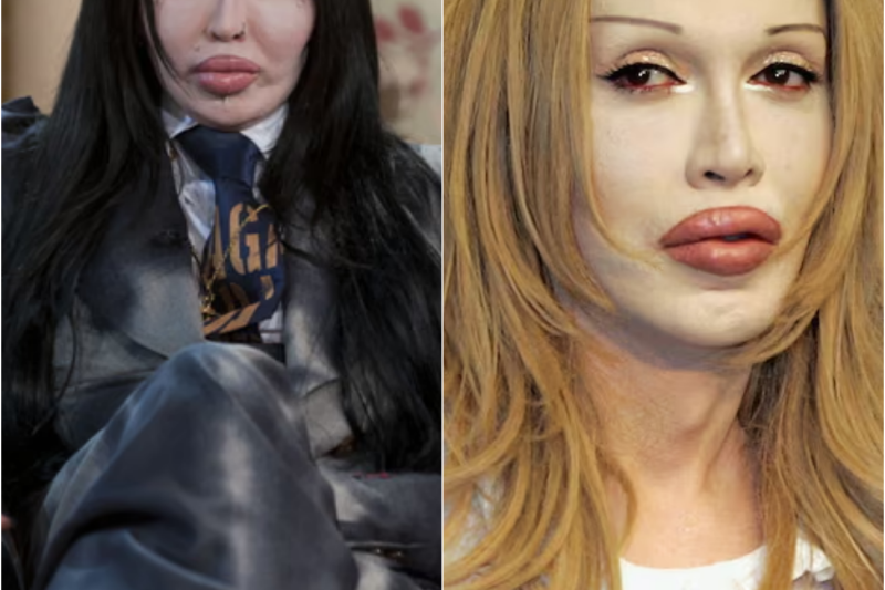 El día que MURIÓ Pete Burns – Biografía del músico ADICT0 a las cirugías